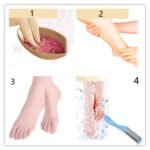 6479 Removing Hard, Cracked, Dead Skin Cells - Professional Callus Remover Foot Corn Remover