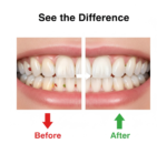 Smart Water Flosser Teeth Cleaner For Cleaning Teeth - Image 4