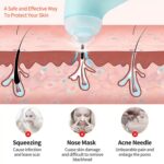 Mini Handheld Vacuum Blackhead Remover – Facial Massage & Spot Lifting (1 Pc) - Image 5